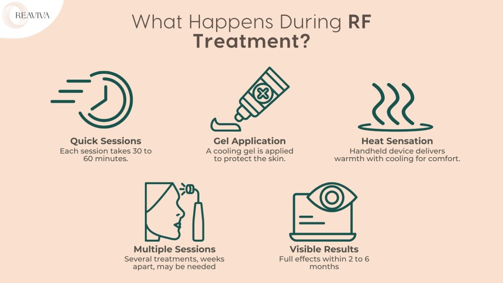 An overview of what happens during RF (Radio Frequency) treatment. The procedure includes quick sessions lasting 30 to 60 minutes, a cooling gel application to protect the skin, and a heat sensation from a handheld device that delivers warmth with cooling for comfort. Multiple sessions spaced weeks apart may be required for optimal results. Visible improvements in skin texture and firmness appear within 2 to 6 months. RF treatment is designed for non-invasive skin tightening and rejuvenation.